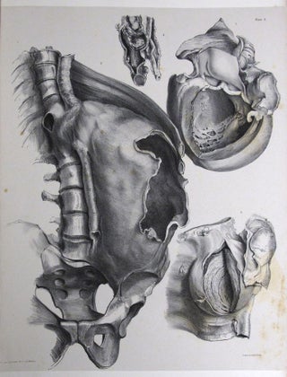 Item #151375 THE SECOND FASCICULUS OF ANATOMICAL DRAWINGS, Chatham Army Medical Museum