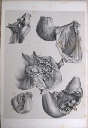 THE SECOND FASCICULUS OF ANATOMICAL DRAWINGS,